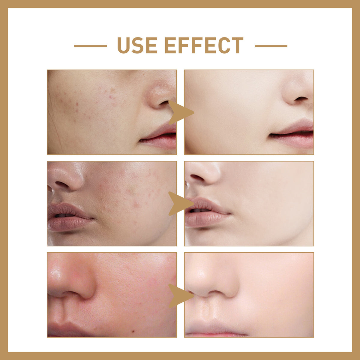 Hydrating, moisturizing, moisturizing and radiant toner