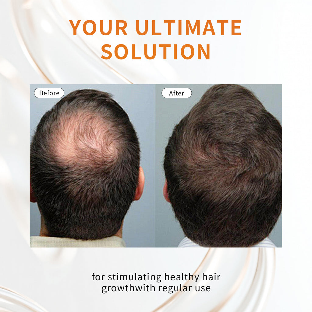 Rosemary Grape Seed Hair Oil