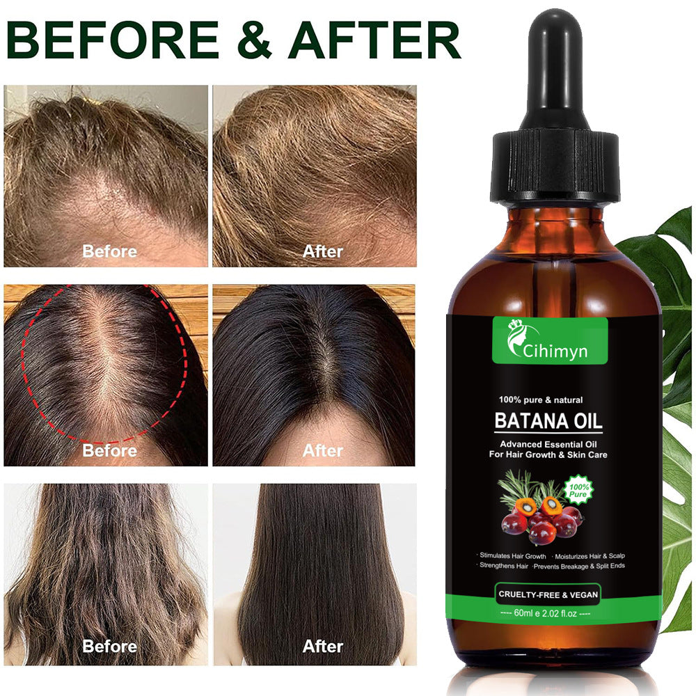 Anti-Relaxation Hair Strengthening and Nourishing Essential Oil