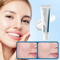 Tranexamic Acid Spot Cream for Hydration and Brightening
