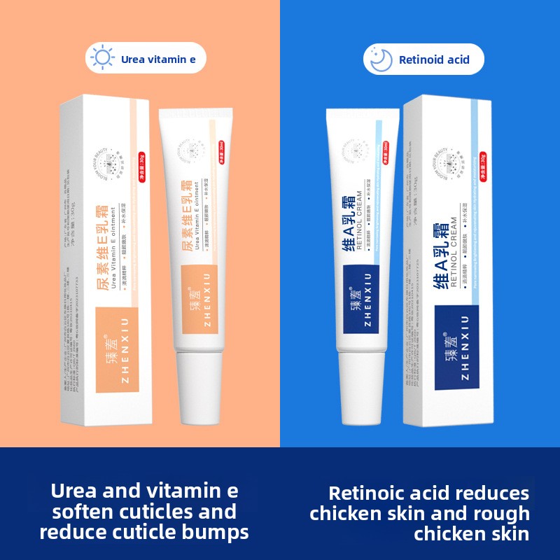 Vitamin A Urea Cream for Softening and Acne Treatment