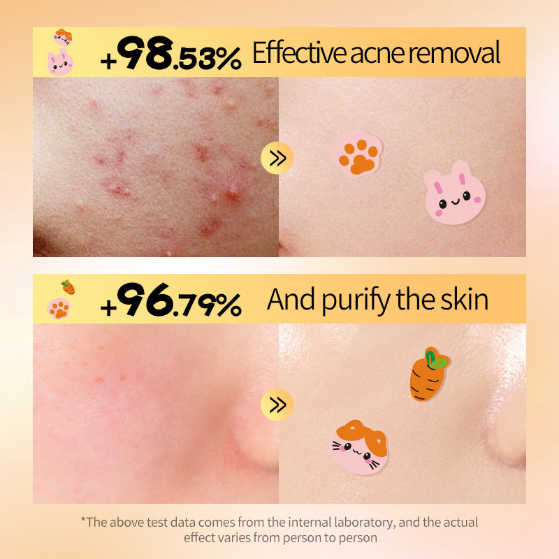 Rabbit and Cat Acne Patches 40 Pieces  Acne Patches