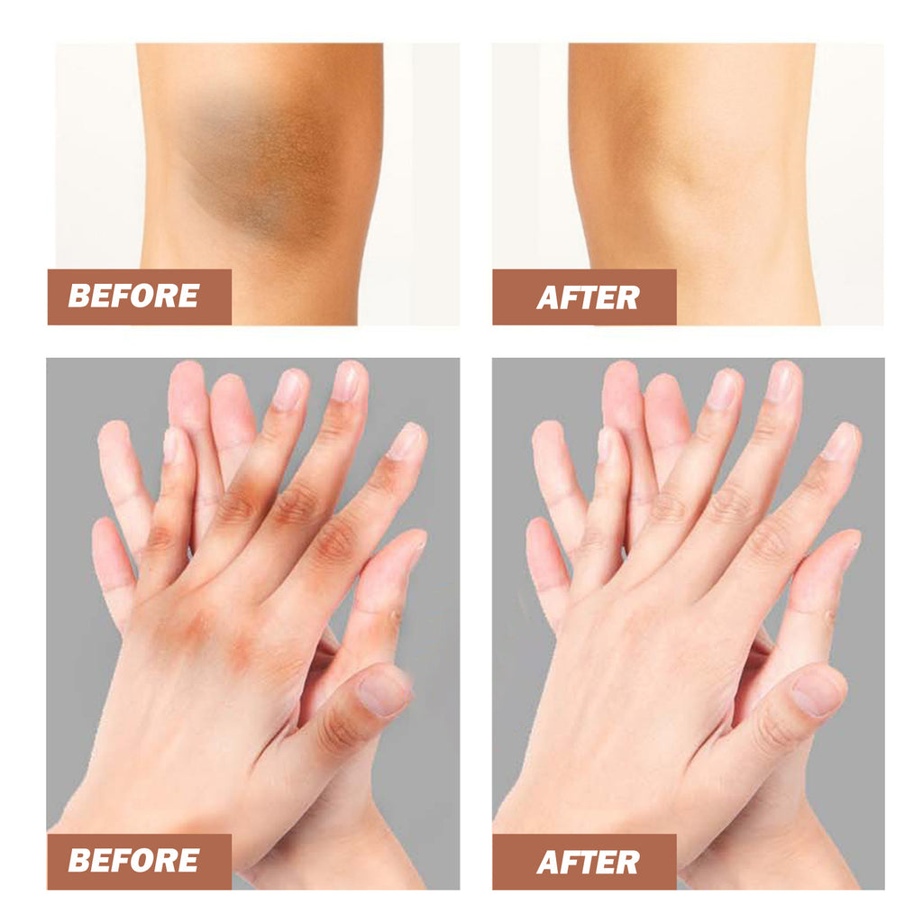 Exfoliating and Brightening Cream