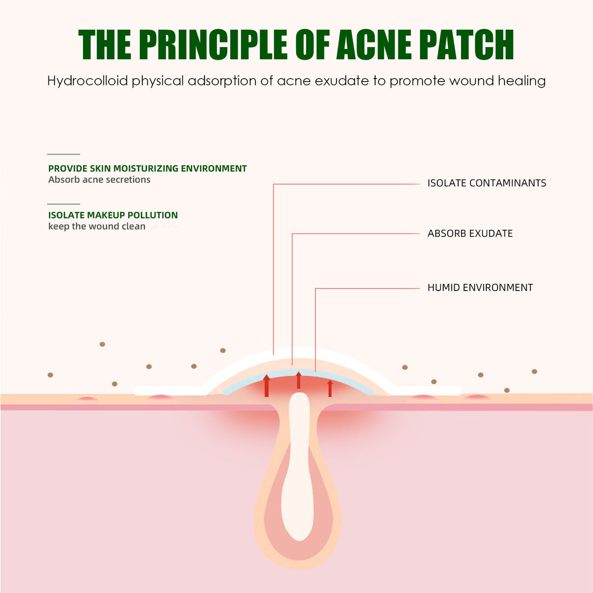 Liquid-Absorbing Acne Patches
