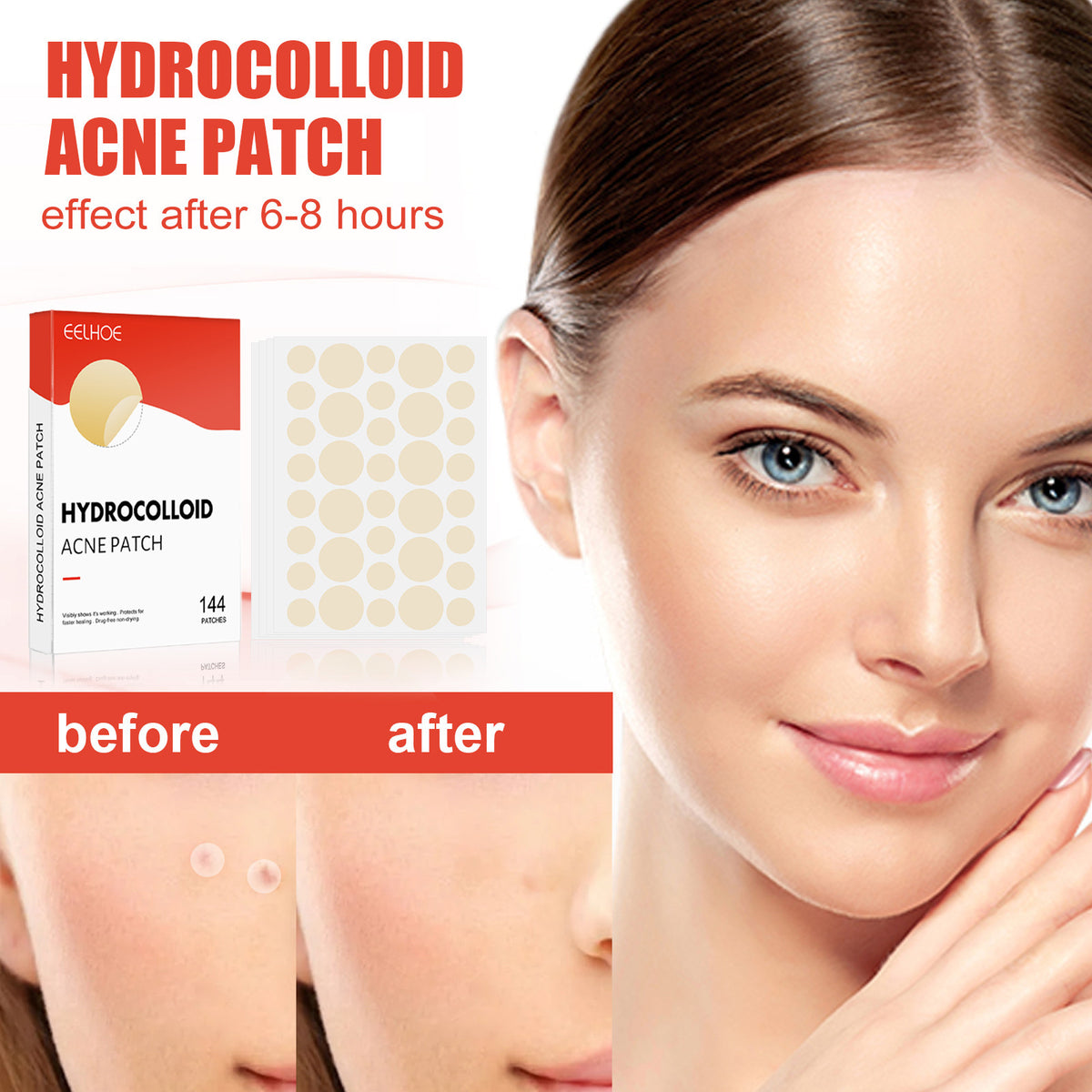 Hydrocolloid acne patch