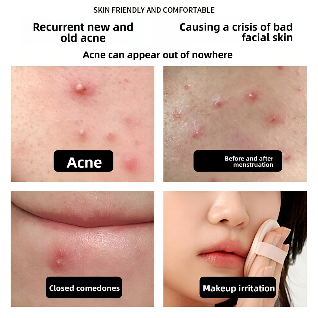 Glitter Hydrocolloid Acne Patches