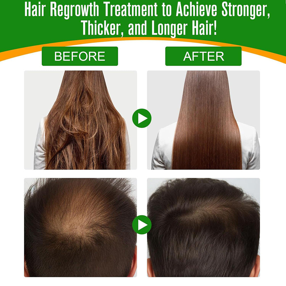 Anti-Relaxation Hair Strengthening and Nourishing Essential Oil