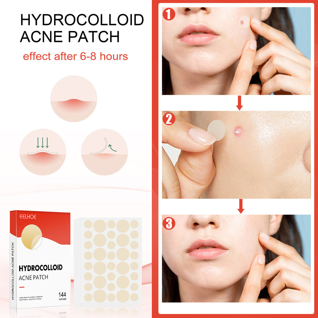 Hydrocolloid acne patch