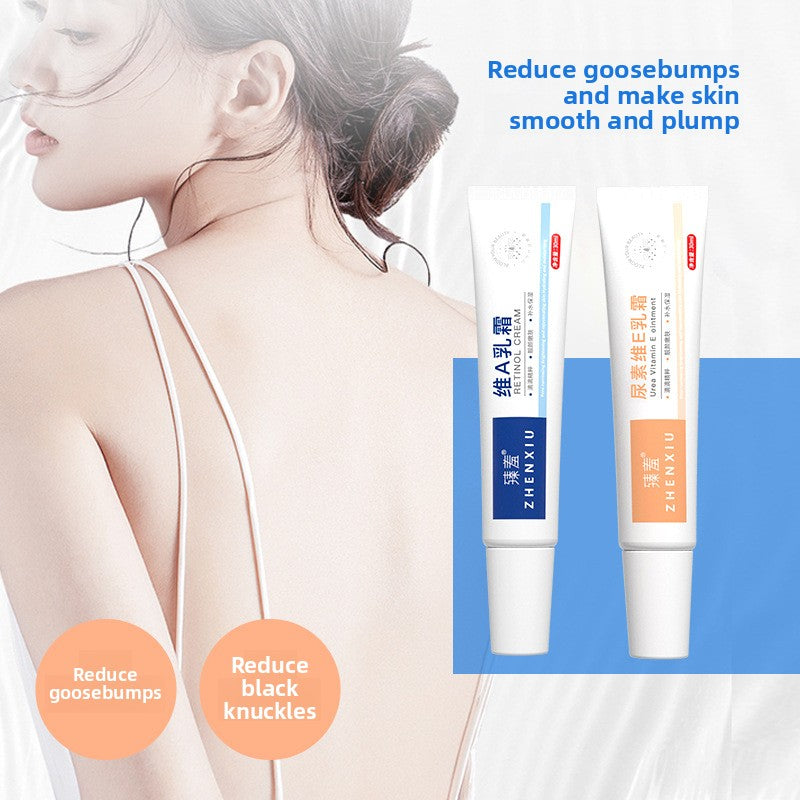 Vitamin A Urea Cream for Softening and Acne Treatment