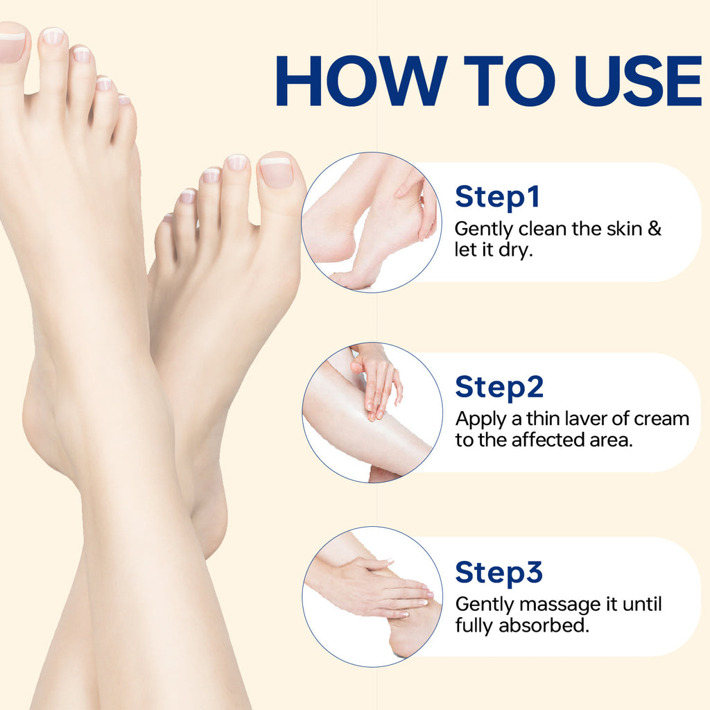 Urea Salicylic Acid Hand Foot Cream