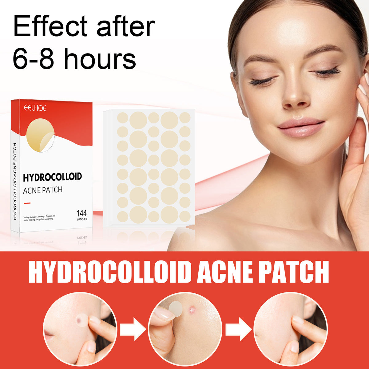 Hydrocolloid acne patch