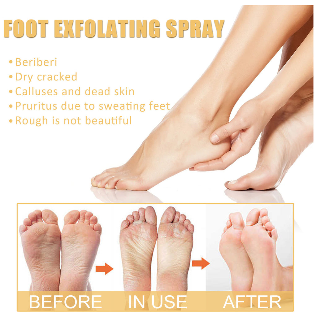 Ouhoe Moisturizing Foot Care Spray