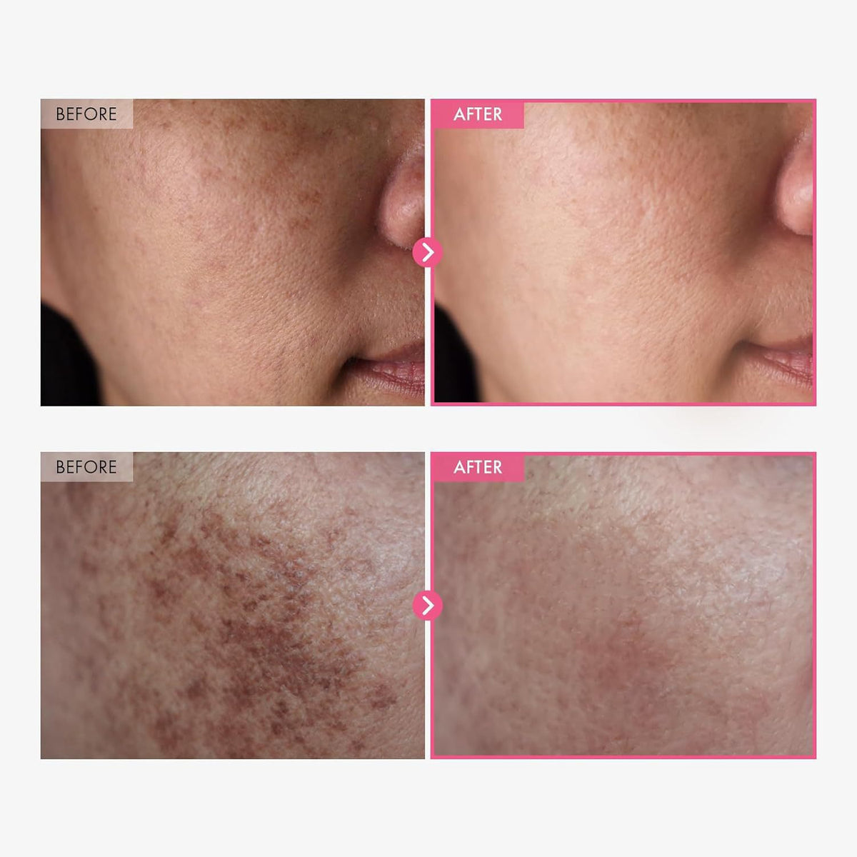 Arbutin Niacinamide Face Cream