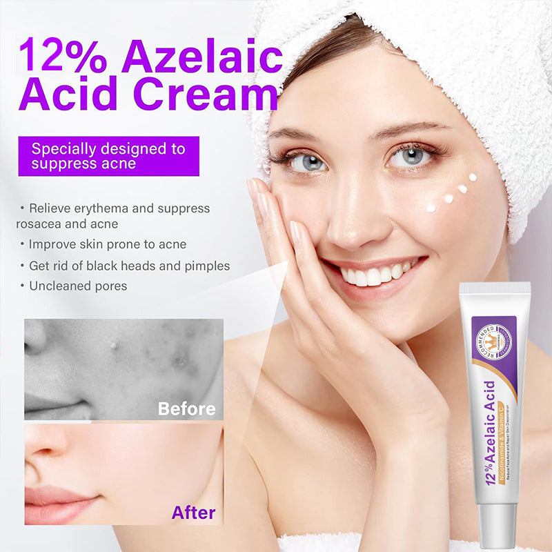 15% Azelaic Acid Serum to Reduce Acne Scars and Marks