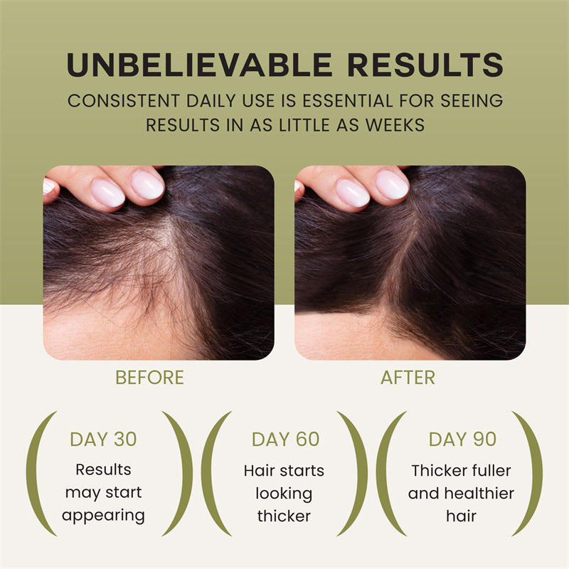 Hair Treatment Oil