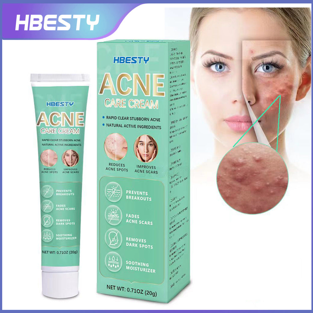 Herbal Acne Treatment Cream