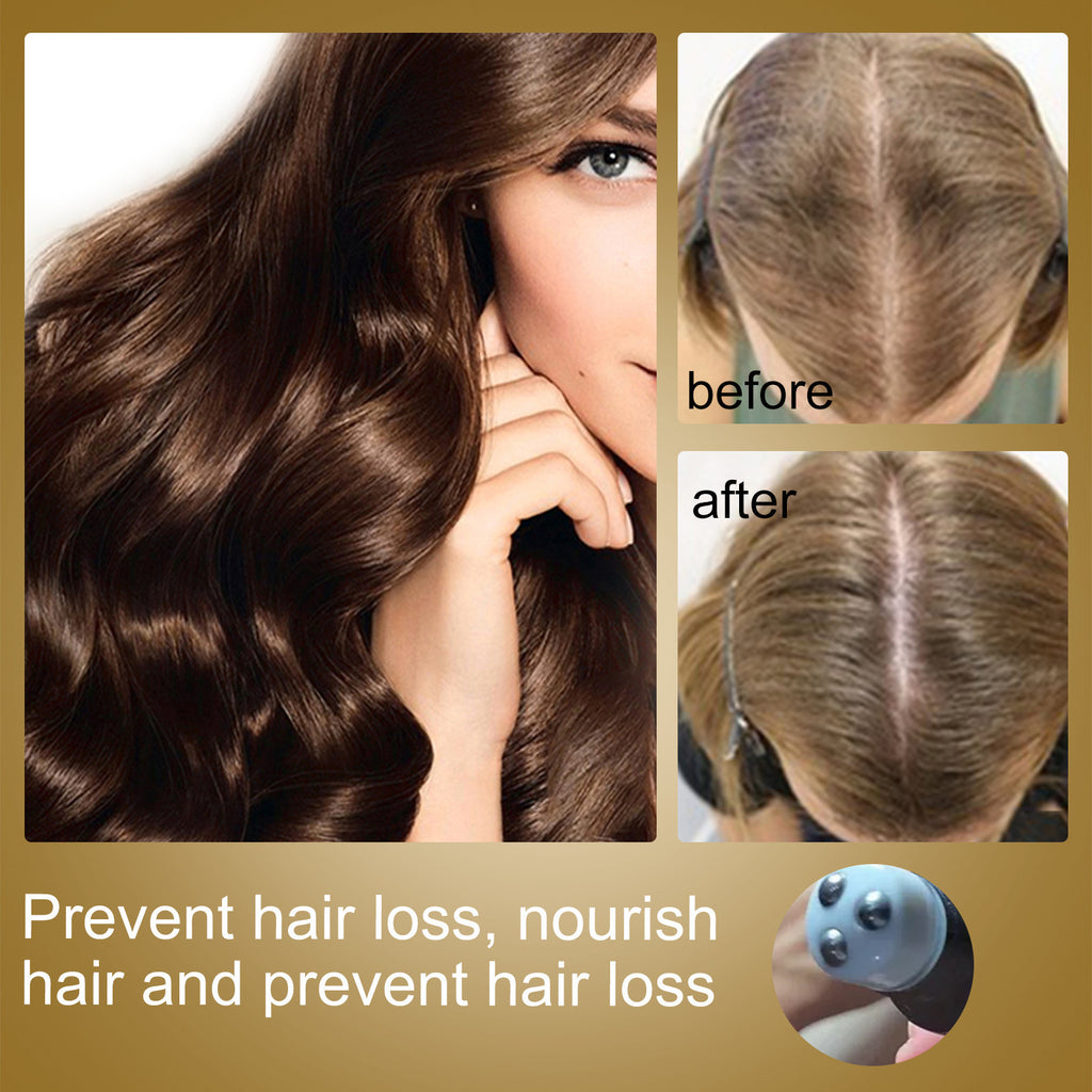 Roll-On Hair Massage Liquid for Scalp Nourishment