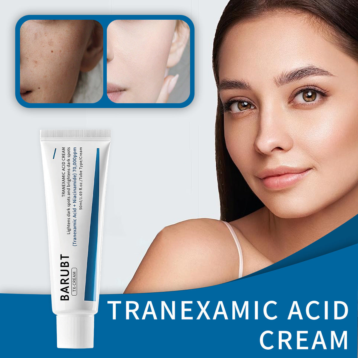 Tranexamic Acid Spot Cream for Hydration and Brightening