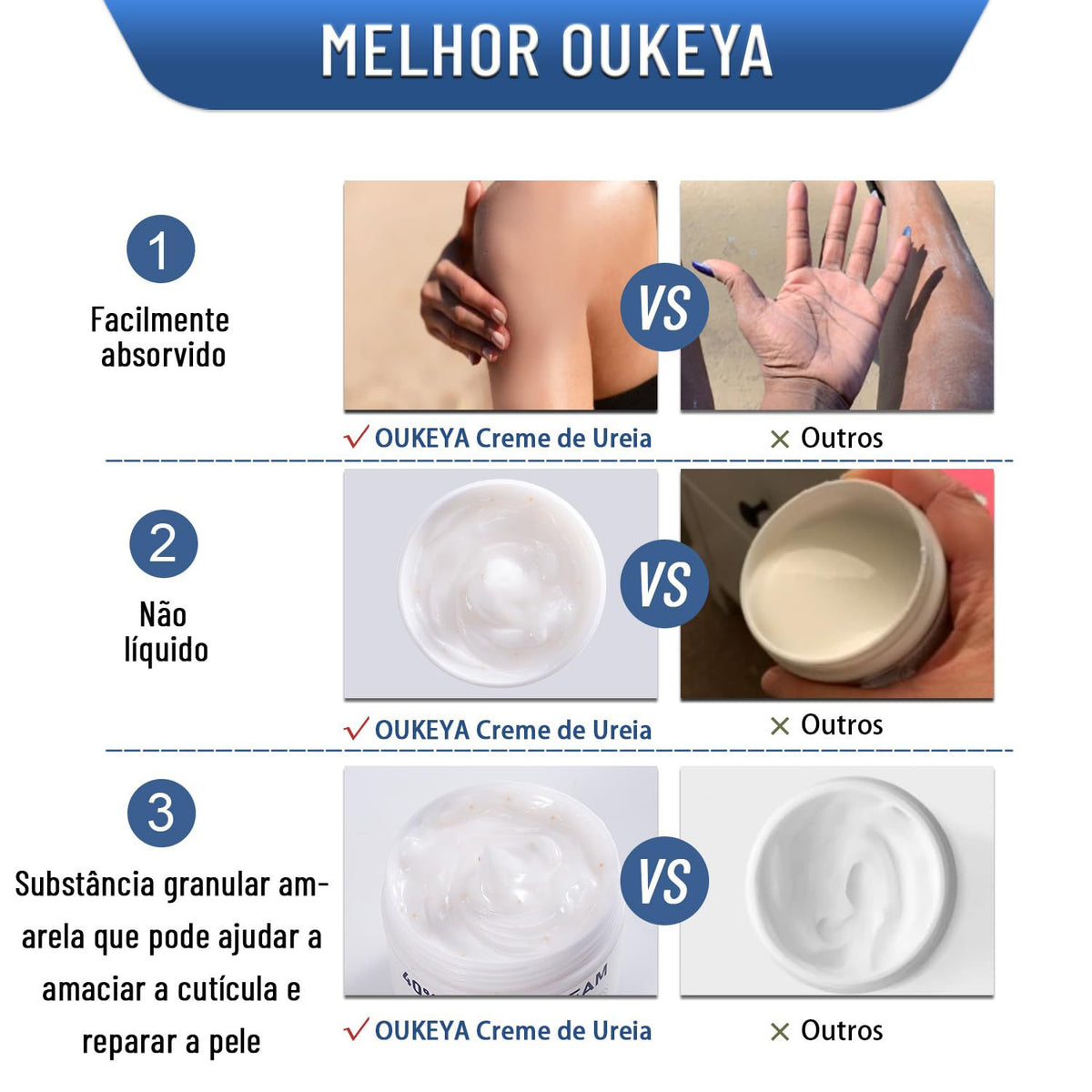 40% Urea Cream for Hands and Feet