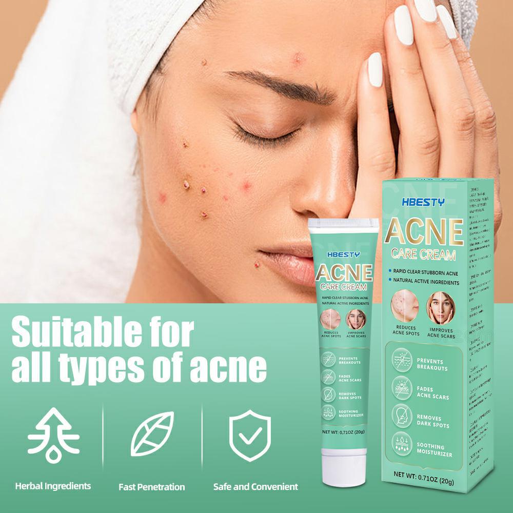 Herbal Acne Treatment Cream