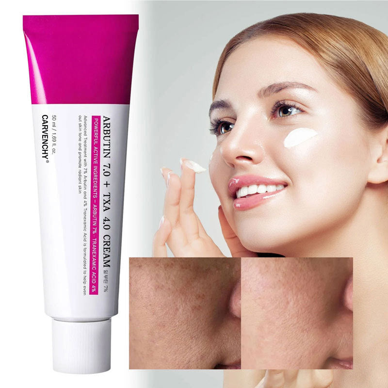 Arbutin Body Cream for Brightening and Hydration