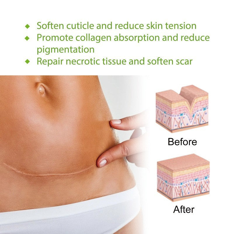 Silicone Gel Self-Adhesive Scar Repair Patch