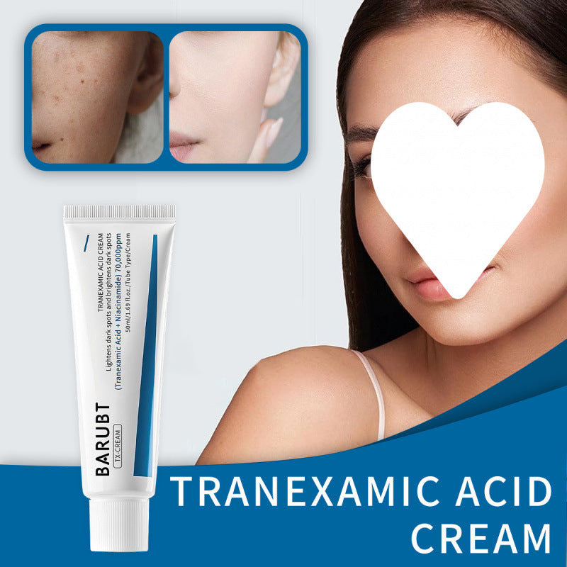 Tranexamic Acid Cream for Chloasma and Moisturizing