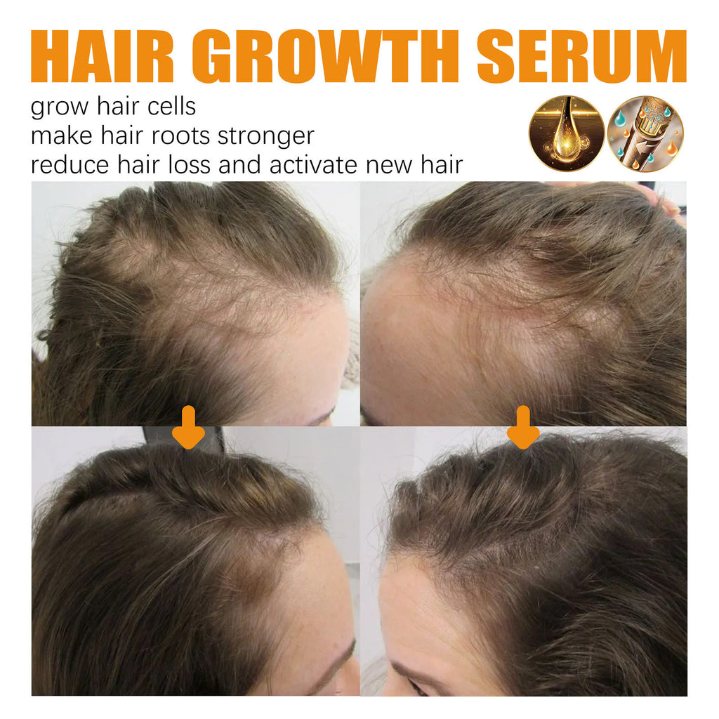 Ginger Hair Fast Growth Serum Spray Biotin Anti Hair Loss