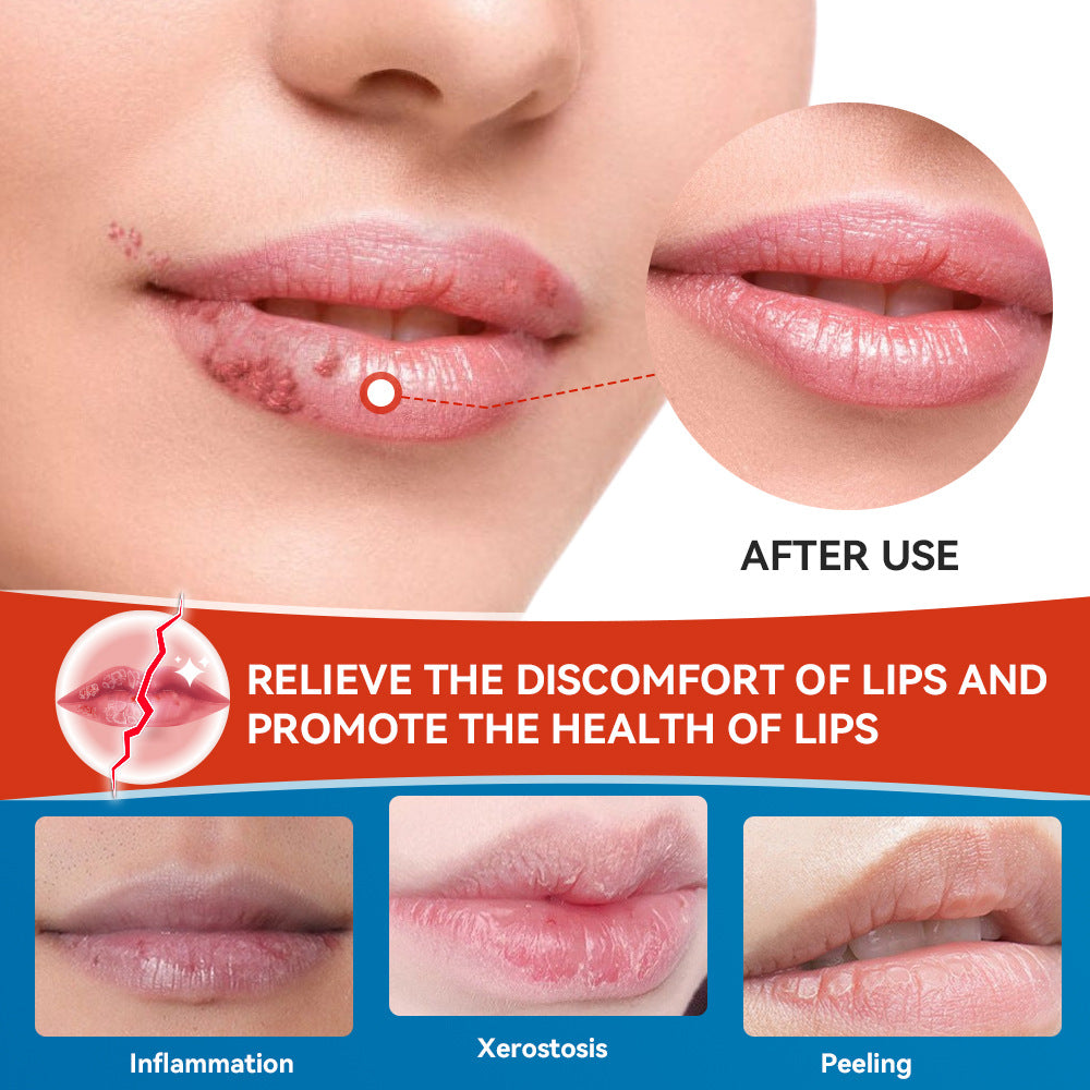 Sumifun Lip Care Cream Moisturizing Lip Balm