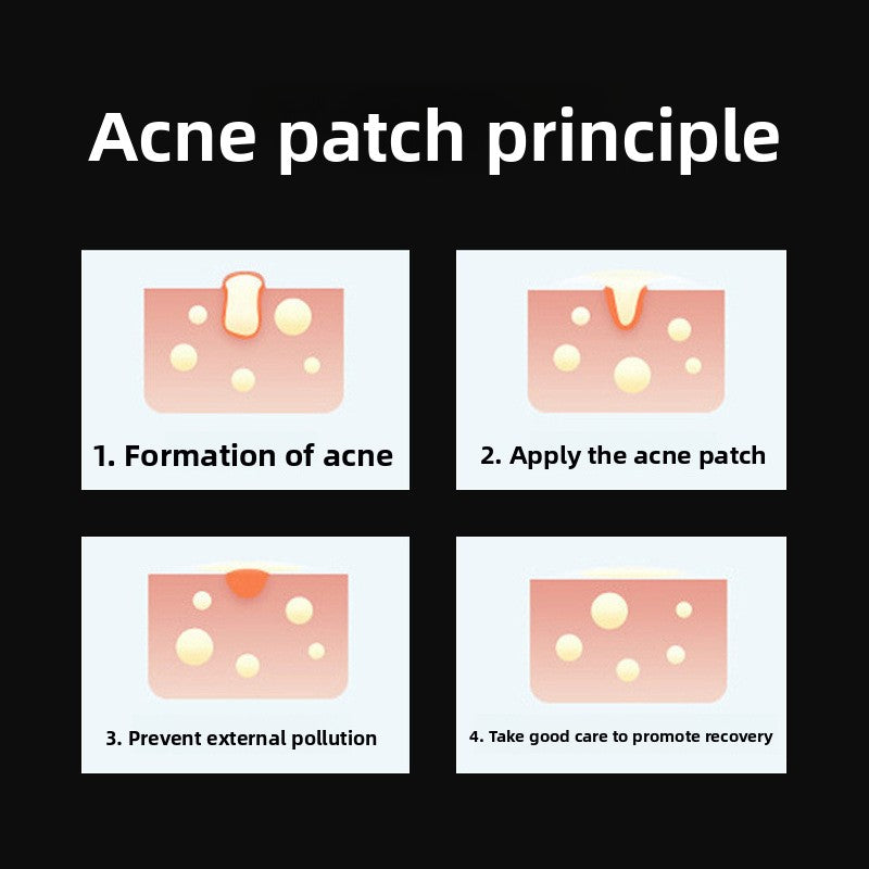 Cartoon Acne Patches
